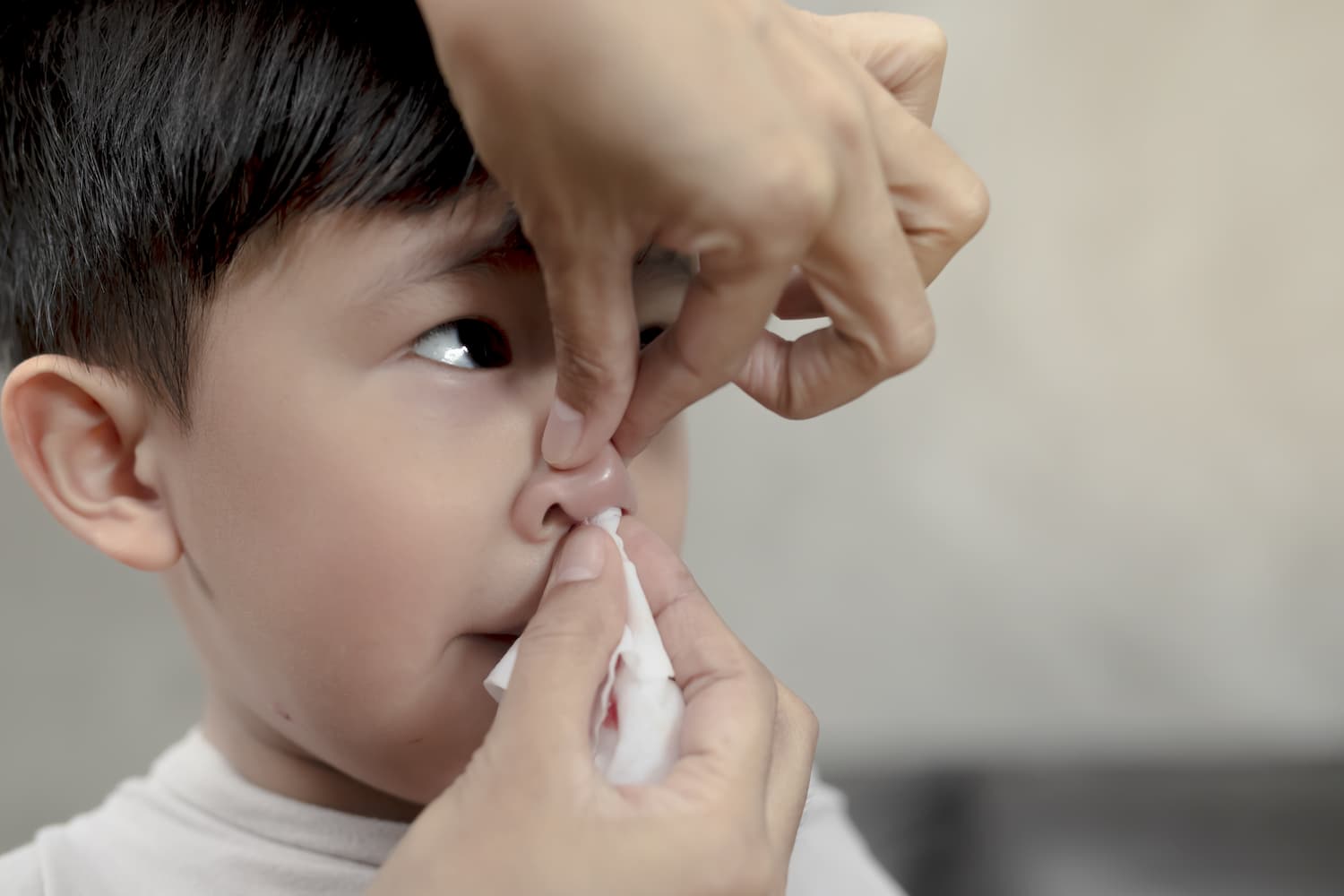 a child with a nosebleed